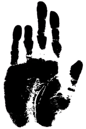 안중근 의사의 손.webp