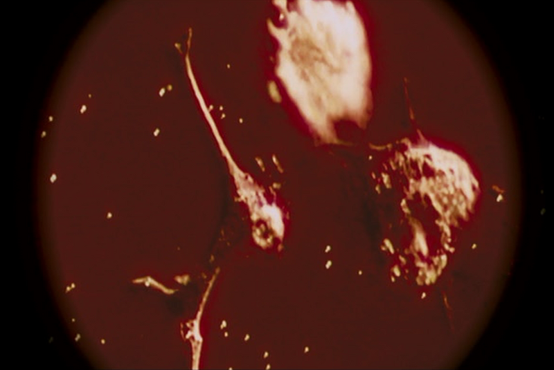 파일:광시병 (시간이여).png